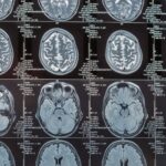 MRI images of a brain.