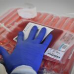 A lab tech preparing to thaw a frozen blood bag containing immune cells that will be modified into CAR T cells.