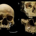 The facial skeleton of a woman whose nose appears to have been severed.