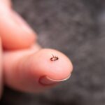 A flea on a person's finger.