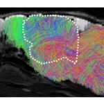 Map of estimated nerve-fiber pathways in the brain of a xenocortical (XCX) mouse.