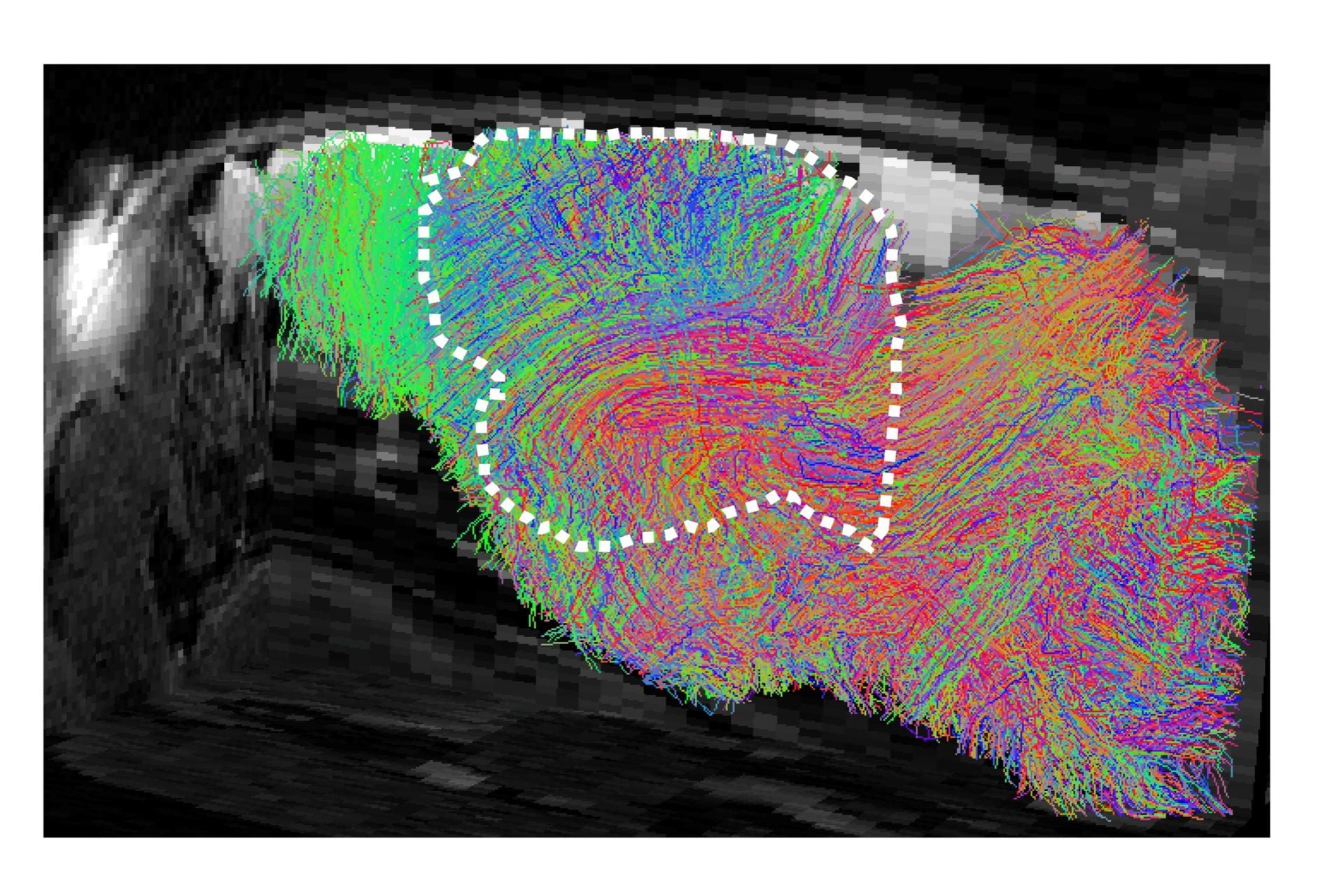 Map of estimated nerve-fiber pathways in the brain of a xenocortical (XCX) mouse.