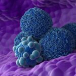 An illustration of pancreatic cancer cells.