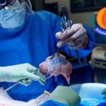 Robert Montgomery picking up a gene-edited pig kidney during a xenotransplantation procedure performed in November 2024.
