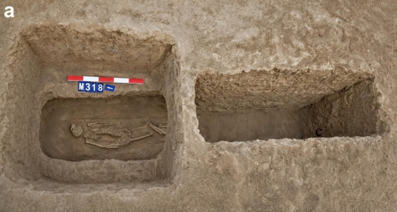 tomb-nasal-amputation-e1790019242458-1280x684-1 Tomb Nasal Amputation
