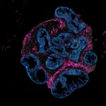 2DOrganoidSlice_greynuclei_pinksmoothmuslce_blueepithelium_