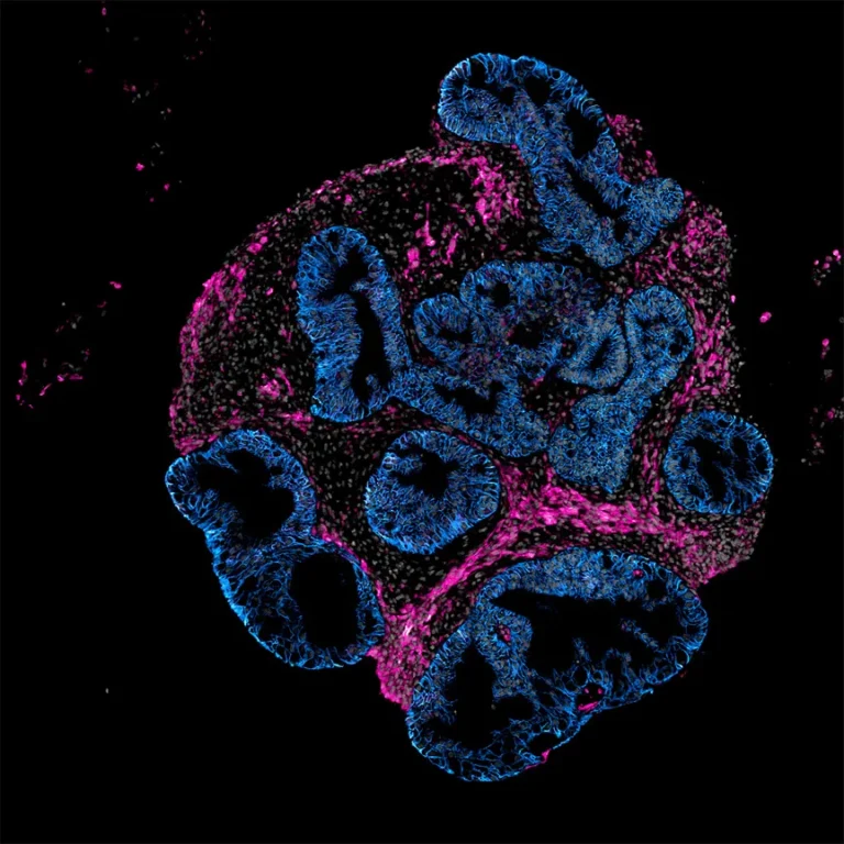2DOrganoidSlice_greynuclei_pinksmoothmuslce_blueepithelium_