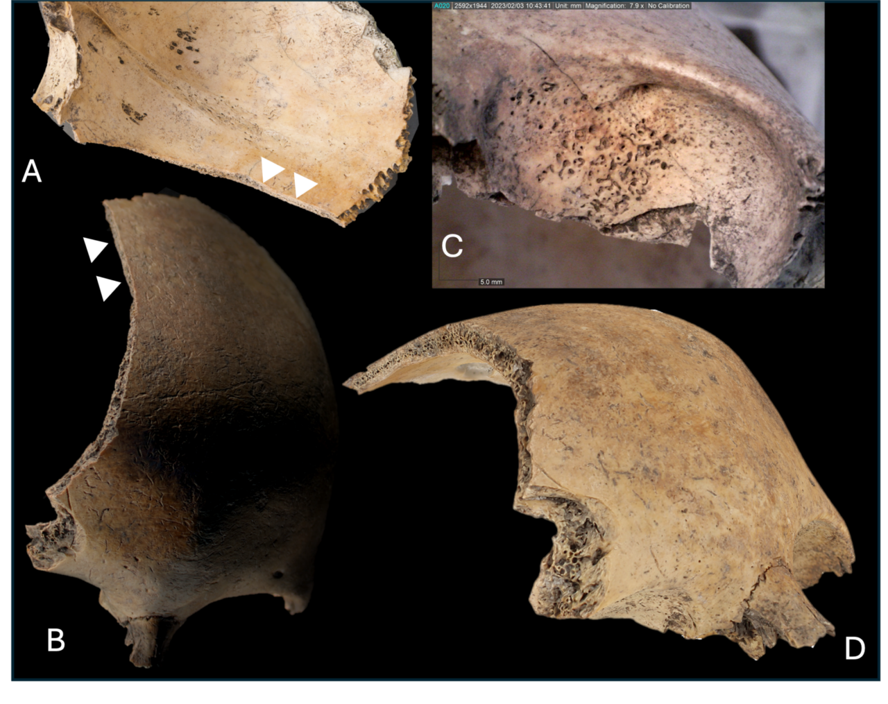 Child Skull Viking Settlement